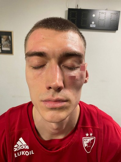 GDE OD SVIH MENE NAĐE... Lazarević konačno oktiro sve o epskoj tuči sa Nanelijem